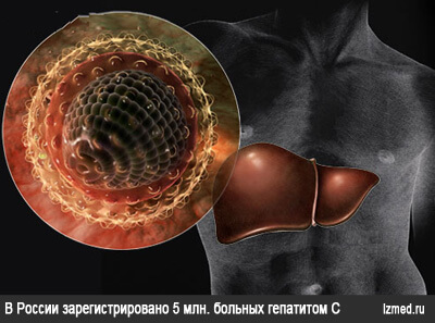 Специфика вируса HCV и пути преодоления проблемы заболеваемости гепатитом С- фото № 1 Специфика вируса HCV и пути преодоления проблемы заболеваемости гепатитом С