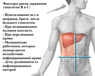 Гепатит С: специфика групп риска- фото № 2 Гепатит С: специфика групп риска