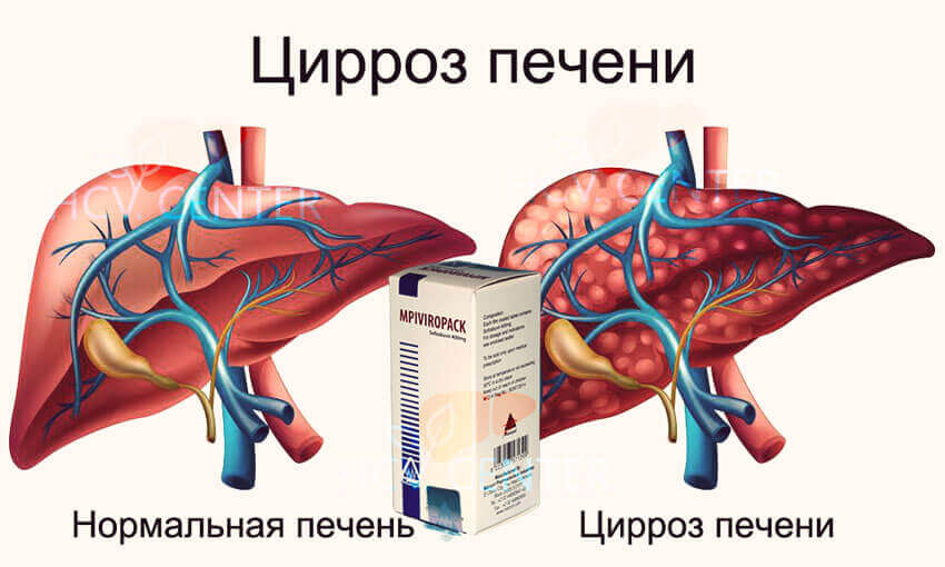 Профилактика ВГС в условиях урбанизации- фото № 3 Профилактика ВГС в условиях урбанизации