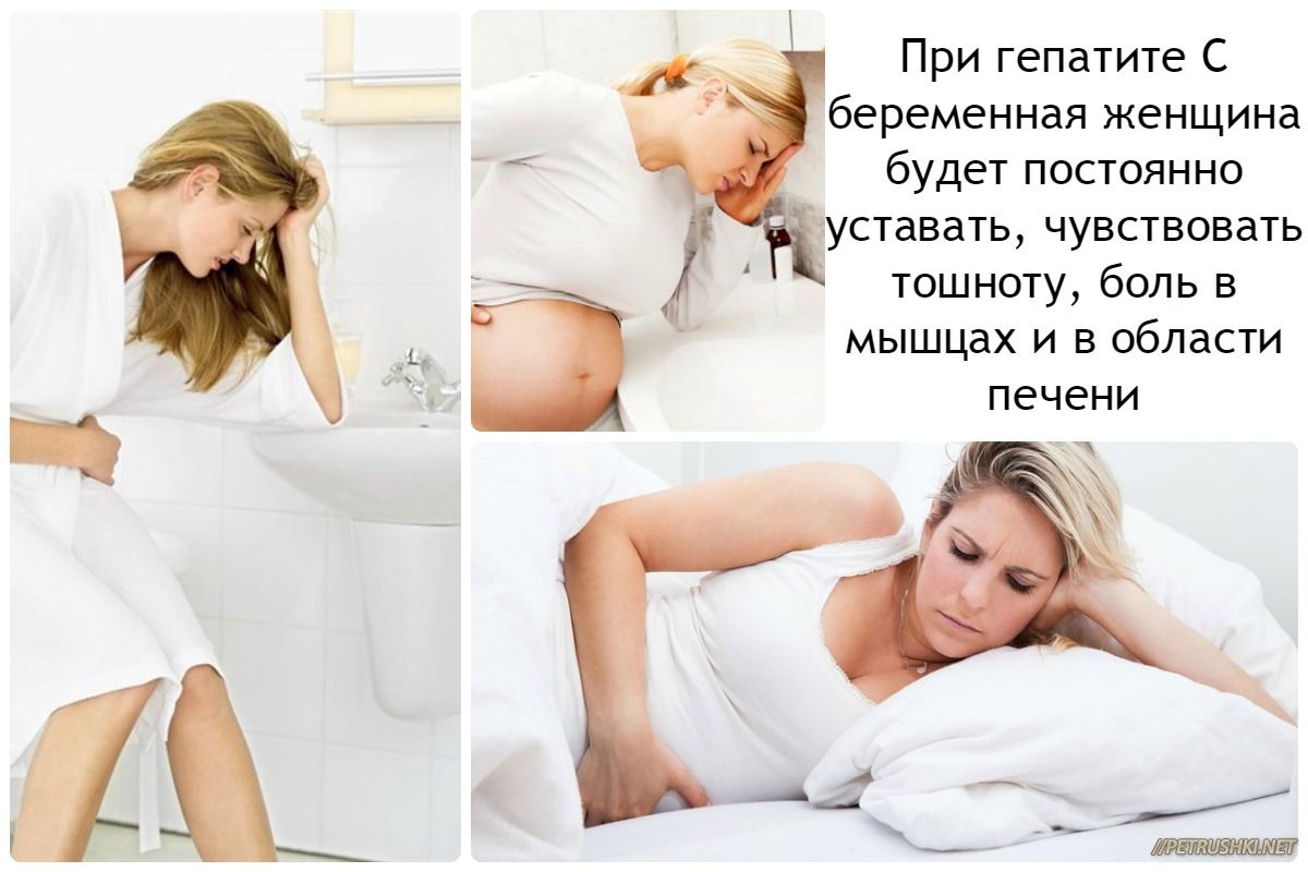 От гепатита С можно вылечиться в любой стране?- фото № 3 От гепатита С можно вылечиться в любой стране?
