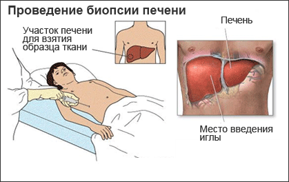 Овощи и фрукты против гепатита С- фото № 1 Овощи и фрукты против гепатита С