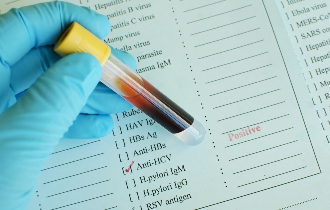 Зачем проходить тест на anti-HCV- фото № 2 Зачем проходить тест на anti-HCV