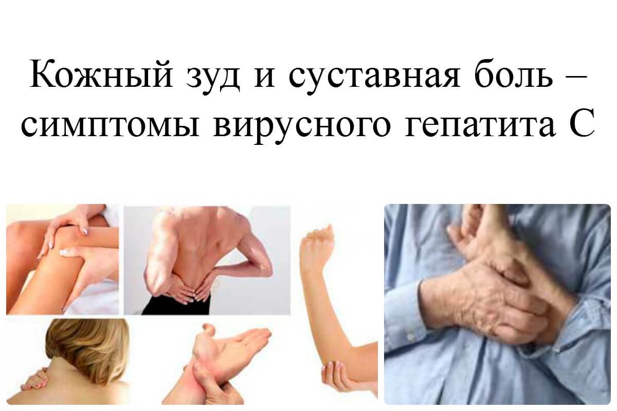 Как развивается острая форма гепатита C в хроническую?