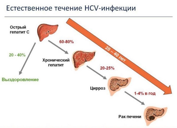 Генотипы гепатита С- фото № 1 Генотипы гепатита С