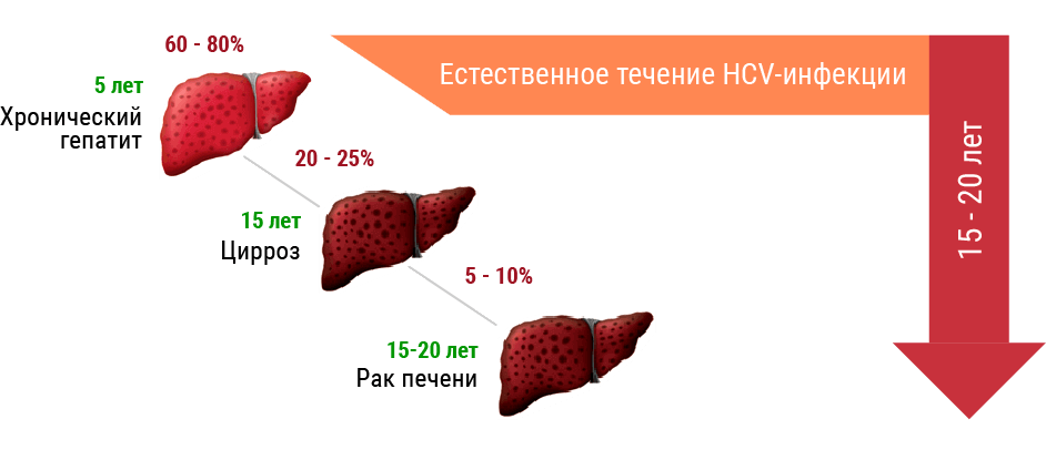 Неблагоприятный исход Неблагоприятный исход