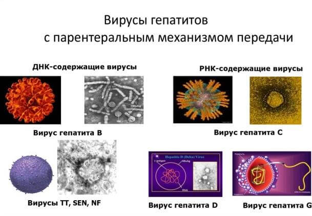 Парентеральный вирусный гепатит что это, классификация, пути заражения Парентеральный вирусный гепатит что это, классификация, пути заражения